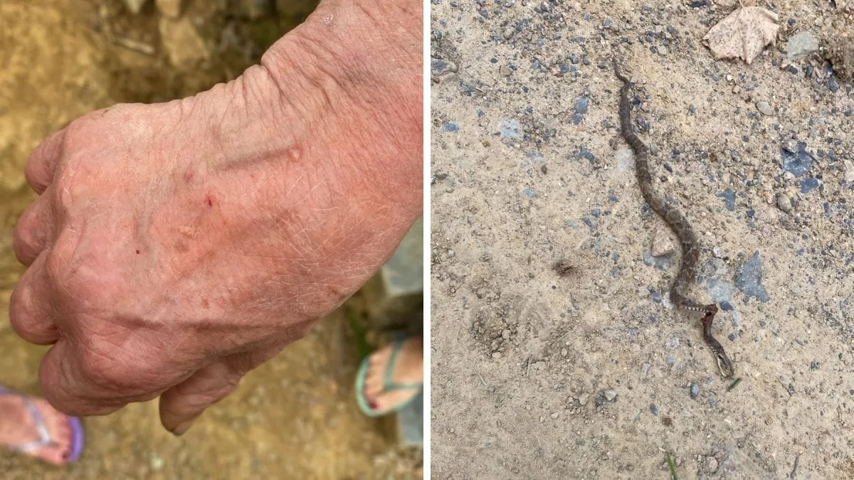 Mulher de 66 anos é picada por jararaca em jardim de casa em SC