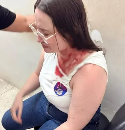 Candidata do PSOL é ferida por pedrada em ato de campanha em Ouricuri